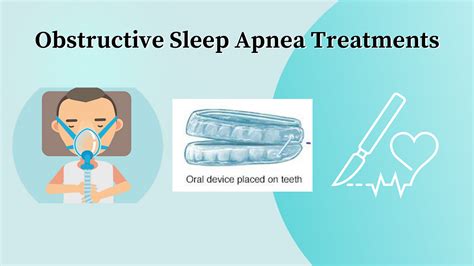 Sleep Apnea Treatment Options