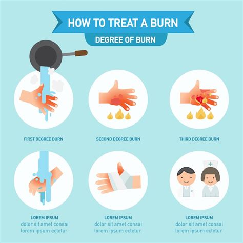 Premium Vector How To Treat A Burn Infographicvector Illustration