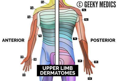 Dermatome Upper Limb