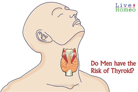 Do Men Have The Risk Of Thyroid Live Homeo