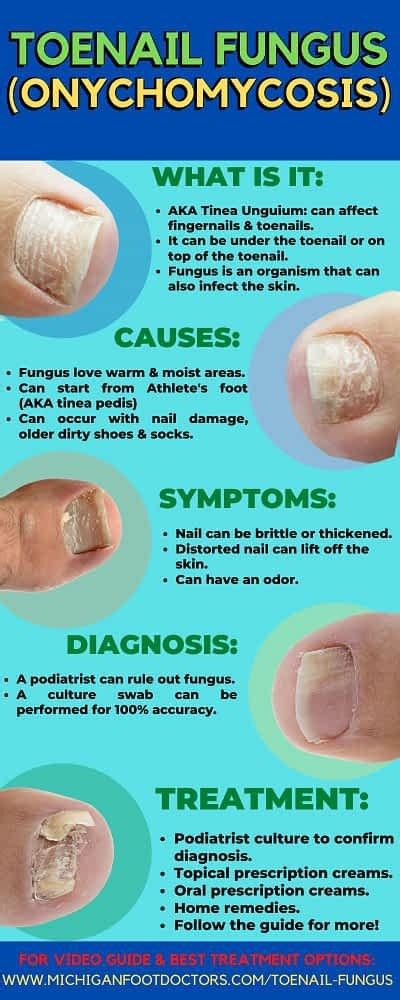 Pseudomonas Nail Infection Causes Symptoms And Best Treatment