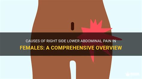 Causes Of Right Side Lower Abdominal Pain In Females A Comprehensive Overview Medshun