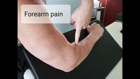 Wrist And Forearm Pain Cheapest Deals Save 60 Jlcatjgobmx