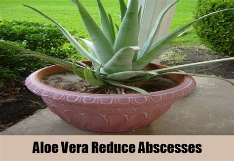 10 Different Home Remedies For Abscesses Search Home Remedy