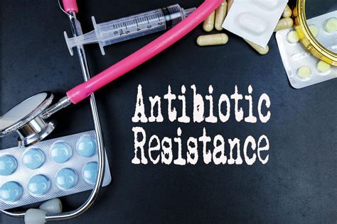 “i Need An Antibiotic” Sinus And Allergy Wellness Center Otolaryngology