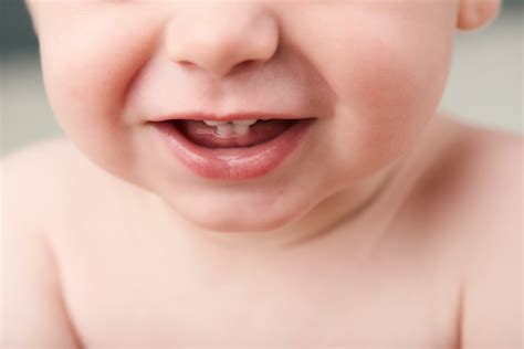 Heres Why Some Babies Are Born With Teeth Cirocco Dental Center