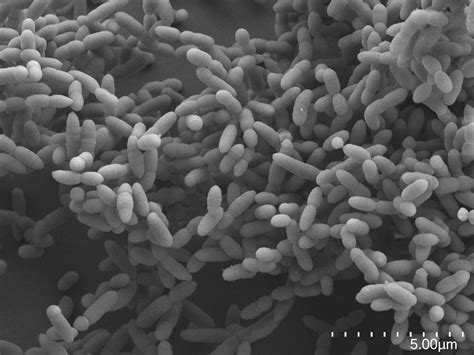First Overview Of Archaea In Vertebrates
