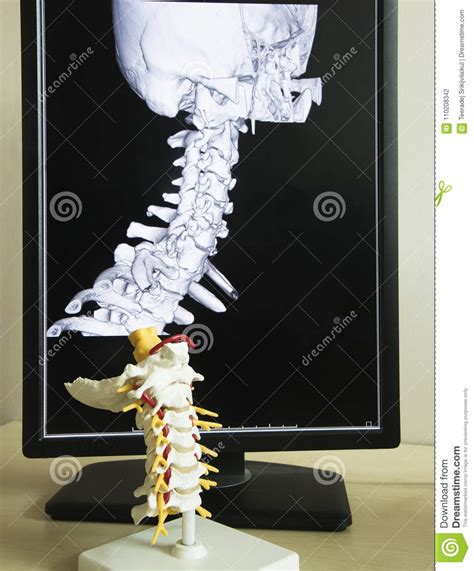 Cervical Spine Model And Mri Picture Stock Photo Image Of Medical