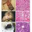 Fig {D} 1 Mast Cell Tumor Skin Dog Multicentric Dermal Grayish 