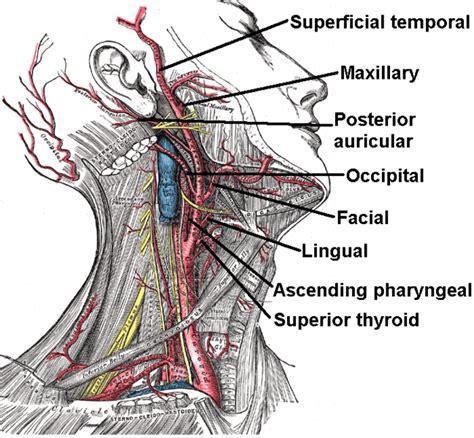 Background and purpose a subject with dissection of the internal carotid artery (ica) may present with a variety of symp toms, from headache to stroke. ON - RADIOLOGY: External carotid artery mnenomic