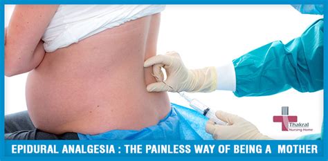 Epidural Analgesia The Painless Way Of Being A Mother Blog Thakral