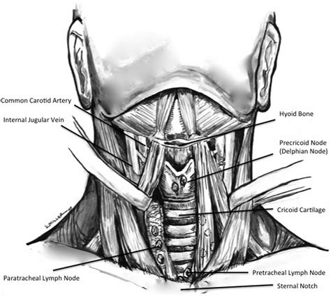 Surgical Management Of Lymph Node Compartments In Papillary Thyroid