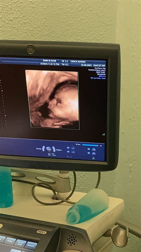 Baby Photos Ultrasound Technician Baby Ultrasound Dream Career Gril