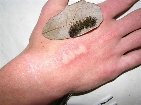 Buck Moth Larvae Itchy Caterpillars Of The Eastern United States Adopt And Shop