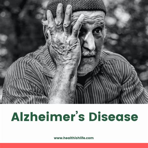 What Is Alzheimer’s Disease Symptoms Causes And Treatment Healthishlife