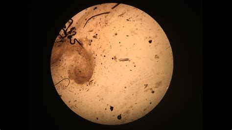 Mikroskop görüntüsü hayvan derisinde mantar aranması biyoloji kimya