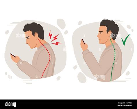 Posture Man Vector Illustration Incorrect Head Angle Using Phone Bad