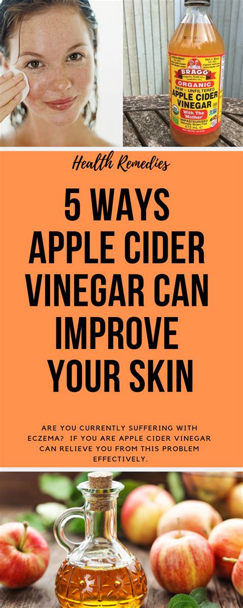 5 Ways Apple Cider Vinegar Can Improve Your Skin Apple Cider Vinegar For Skin Apple Cider