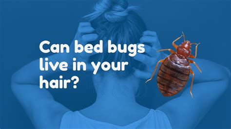 Can Bed Bugs Live In Your Hair Texas Bed Bug Experts