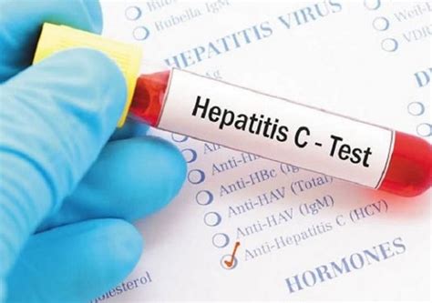 Racgp Dare To Innovate Hepatitis C Models Of Care