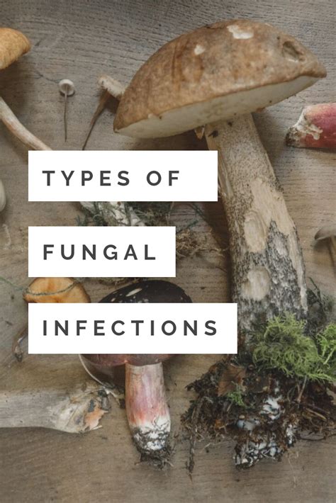 Did you find green nails under your artificial nail? Types of Fungal Infections | Fungal infection, Toenail ...