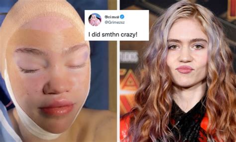 Grimes Posted A Picture After Plastic Surgery And Fans Are Convinced