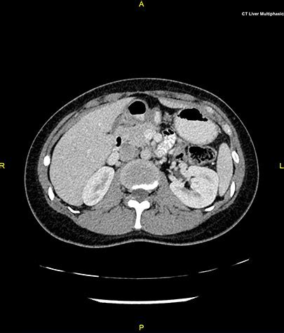 A ct scan can be done on any section of the head or body. Computed Tomography (CT Scan) | MED Expert
