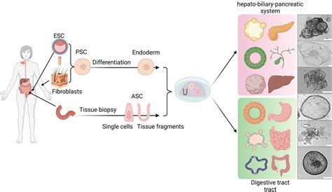Organoids In Gastrointestinal Diseases From Experimental Models To