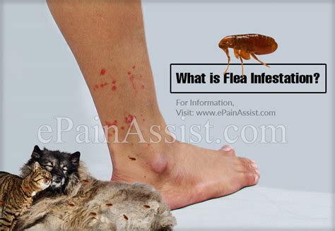What Is Flea Infestation And How To Know If You Got Bitten By A Flea