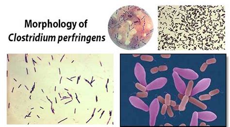 Clostridium Perfringens An Overview Microbe Notes