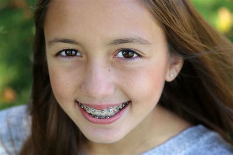 See more ideas about cute braces, braces, braces girls. EMERGENCY DENTIST: WHY IS SUMMER THE BEST TIME FOR YOUR ...