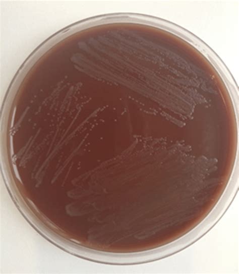 Culture Of Neisseria Gonorrhoeae Ng From A Male Urethral Swab