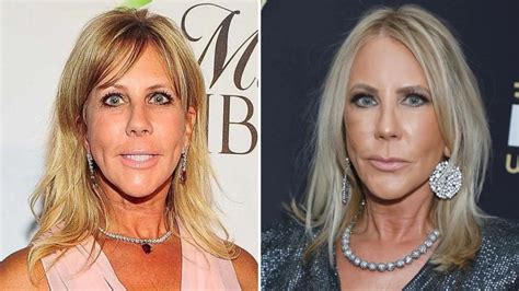 Rhoc’s Vicki Gunvalson Has Been Open About Her Plastic Surgery Journey Transformation Photos