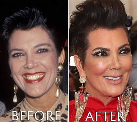 Kris Jenner Young Vs Now