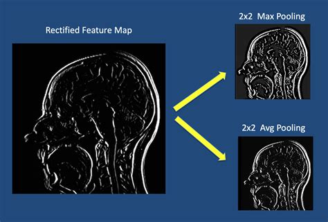 Convolutional Neural Network Questions And Answers In Mri