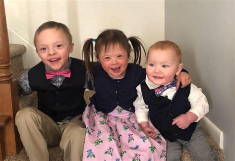 Down Syndrome Down Syndrome 8 Facts To Know Typically A Baby Is