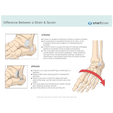 Difference Between A Strain And Sprain