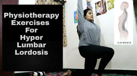Physiotherapy Treatment For Hyper Lumbar Lordosis How To Correct Your