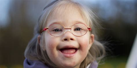The genetic basis of down syndrome. 50 Countries Unite To Fight Medical Discrimination Against ...