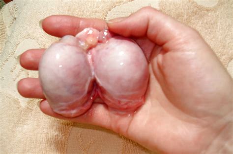 Castrated Trannies Castration Orchectomy Porn Pictures Xxx Photos