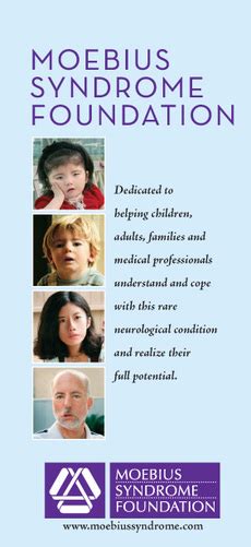 The moebius syndrome foundation's mission is to provide information and support to individuals with moebius syndrome and their families, promote greater awareness and understanding of moebius. Treatment - Möbius Syndrome