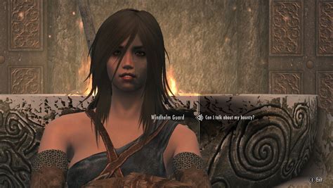 My Botox Files Page 3 Downloads Skyrim Non Adult Mods Loverslab