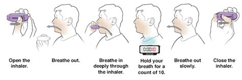 Advair diskus 100/50 (100 mcg fluticasone propionate, 50 mcg salmeterol) advair diskus 250/50 (250 mcg fluticasone propionate, 50 mcg salmeterol) Using Dry-Powder Inhalers (DPIs) | Saint Luke's Health System