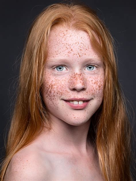 Taches De Rousseur Red Hair Freckles Freckles Cute Girl Dresses