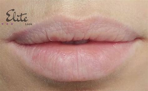 Lip Tattoo Perth | Cosmetic Lip Tattooing Perth | Lip ...