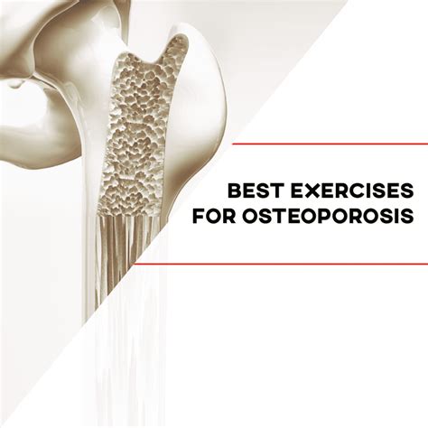 Best Exercises For Osteoporosis P Rehab