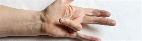 Dupuytrens Contracture Treatment Sydney Orthopaedic Surgeon