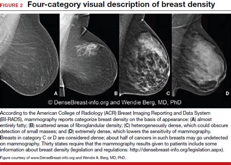 Screening with 3d mammography seemed to find breast cancers at an earlier, more treatable stage in these younger women. Breast density and optimal screening for breast cancer ...