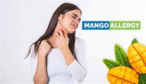 Mango Allergy Symptoms Causes Prevention Treatments More