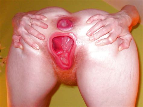 Sex Extreme Fisting Gaping Loose Pussy Big Dildo Image